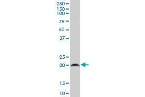 RPL21 polyclonal antibody (A01), Lot # 051220JC01 Western Blot analysis of RPL21 expression in HepG2 . (RPL21 antibody  (AA 2-85))