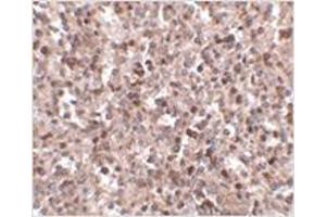 Immunohistochemistry of KLRA1 in human spleen tissue with KLRA1 antibody at 2.