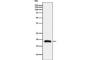 Western blot analysis of ARF5 expression in Hela cell lysate. (Recombinant ARF5 antibody)