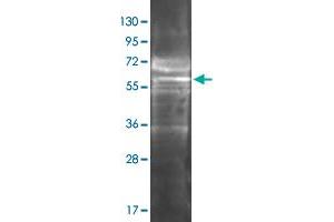 Western Blot analysis by FGA polyclonal antibody  with 1ug protein at 1:3000. (FGA antibody)