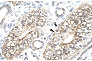 Human kidney (FLJ11730 (N-Term) antibody)