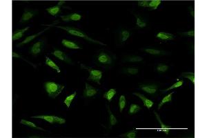 Immunofluorescence of monoclonal antibody to MT2A on HeLa cell. (MT2A antibody  (AA 1-61))