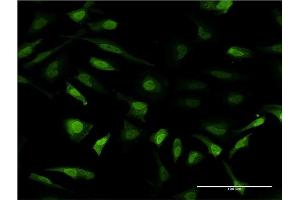 Immunofluorescence of monoclonal antibody to MT2A on HeLa cell.