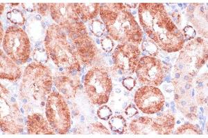 Immunohistochemistry of paraffin-embedded Rat kidney using VASP Polyclonal Antibody at dilution of 1:100 (40x lens). (VASP antibody)