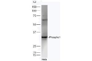 PHOSPHO1 Antikörper  (AA 201-267)