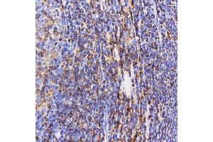 IHC analysis of SEPT6/SEPTIN6 using anti-SEPT6/SEPTIN6 antibody (ABIN7599390). (Septin 6 antibody  (AA 1-434))
