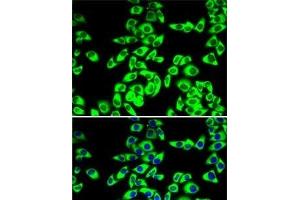 Immunofluorescence analysis of MCF7 cells using RPL14 Polyclonal Antibody (RPL14 antibody)