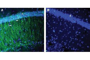 Expression of CCR2 in mouse hippocampus.