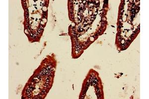 Immunohistochemistry of paraffin-embedded human small intestine tissue using ABIN7159804 at dilution of 1:100 (Midkine antibody  (AA 21-143))