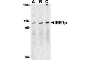 Western Blotting (WB) image for anti-Endoplasmic Reticulum To Nucleus Signaling 1 (ERN1) (C-Term) antibody (ABIN1030448) (ERN1 antibody  (C-Term))