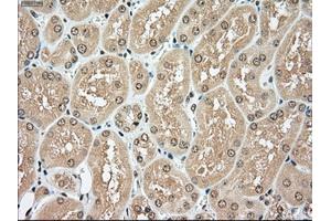 Immunohistochemical staining of paraffin-embedded pancreas tissue using anti-TYRO3mouse monoclonal antibody. (TYRO3 antibody)