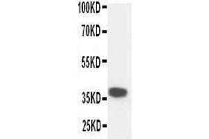 Anti-Kallikrein 5 antibody, Western blotting WB: Mouse Liver Tissue Lysate (Kallikrein 5 antibody  (C-Term))