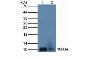 Figure. (PLA2G2A antibody  (AA 21-144))
