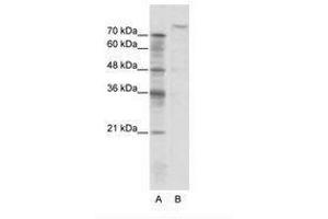 Image no. 1 for anti-Zinc Fingers and Homeoboxes 2 (ZHX2) (N-Term) antibody (ABIN202930)