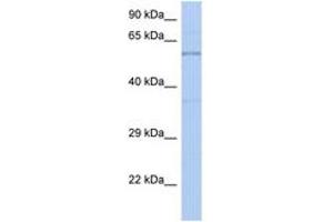 Image no. 1 for anti-Tyrosine Hydroxylase (TH) (AA 35-84) antibody (ABIN6742196) (Tyrosine Hydroxylase antibody  (AA 35-84))