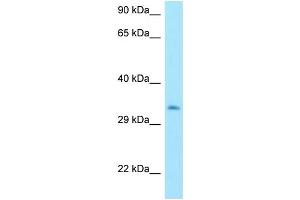 WB Suggested Anti-MTX3 Antibody Titration: 1. (MTX3 antibody  (C-Term))