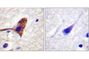 Immunohistochemistry analysis of paraffin-embedded human brain tissue, using mTOR (Ab-2481) Antibody. (MTOR antibody  (AA 2447-2496))