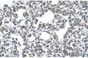 Human Lung (TMPRSS11D antibody  (N-Term))