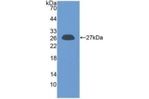 WB of Protein Standard: different control antibodies against Highly purified E. (Prolactin CLIA Kit)