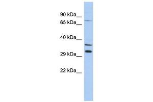 TSGA13 antibody used at 1 ug/ml to detect target protein. (TSGA13 antibody  (Middle Region))