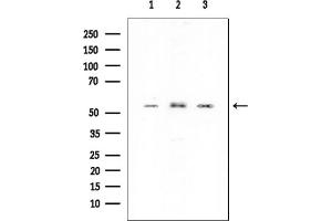 Western blot analysis of lysates from various samples, using PHGDH Mouse Monoclonal Antibody at 1/1000 dilution.
