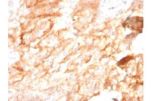 Formalin-fixed, paraffin-embedded human Kidney stained with CD10 Mouse Monoclonal Antibody (MME/2590). (MME antibody  (AA 297-483))