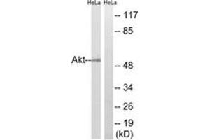 Western blot analysis of extracts from HeLa cells, using Akt (Ab-473) Antibody. (AKT1 antibody  (AA 431-480))