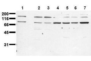 Western Blotting (WB) image for anti-Insulin Receptor (INSR) (Beta Chain) antibody (ABIN126820)