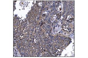 IHC analysis of DLGAP1 using anti-DLGAP1 antibody (ABIN7600257). (DLGAP1 antibody  (AA 17-319))