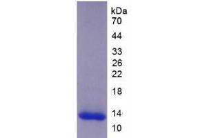 SDS-PAGE analysis of Human ADAMTS8 Protein. (ADAMTS8 Protein)