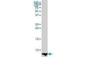 ATOX1 monoclonal antibody (M02), clone 3A2. (ATOX1 antibody  (AA 1-68))