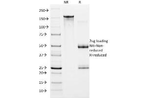 SDS-PAGE (SDS) image for anti-Hypoxia Inducible Factor 1, alpha Subunit (Basic Helix-Loop-Helix Transcription Factor) (HIF1A) (AA 329-530) antibody (ABIN6939616)