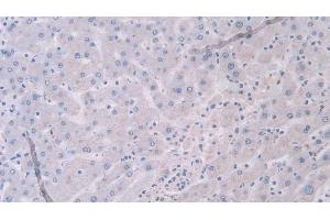 Detection of TNX in Human Liver Tissue using Polyclonal Antibody to Tenascin X (TNX)