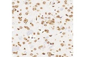 Immunohistochemistry analysis of paraffin-embedded mouse brain using,GSTT1 (ABIN7074091) at dilution of 1: 2000 (GSTT1 antibody)