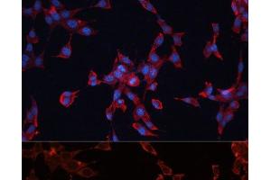 Immunofluorescence analysis of NIH-3T3 cells using GPC3 Polyclonal Antibody at dilution of 1:100 (40x lens). (Glypican 3 antibody)