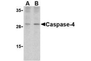Western blot analysis of caspase-4 in human spleen cells with AP30198PU-N caspase-4 antibody at (A) 1 and (B) 2 μg/ml. (Caspase 4 antibody  (Intermediate Domain))