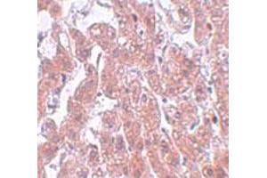 Immunohistochemical staining of human brain tissue with 5 ug/mL FAM59A polyclonal antibody . (FAM59A antibody  (C-Term))