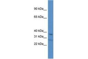 Image no. 1 for anti-Transcription Elongation Factor A (SII), 3 (TCEA3) (AA 244-293) antibody (ABIN6747276) (TCEA3 antibody  (AA 244-293))