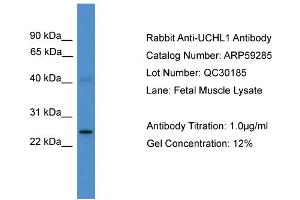 WB Suggested Anti-UCHL1  Antibody Titration: 0. (UCHL1 antibody  (C-Term))