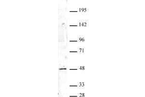 HOXA9 antibody (pAb) tested by Western blot. (HOXA9 antibody  (N-Term))