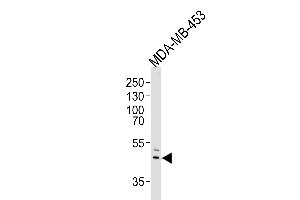 Western blot analysis of lysate from MDA-MB-453 cell line, using IL5RA Antibody (N-term) (ABIN651428 and ABIN2840234). (IL5RA antibody  (N-Term))