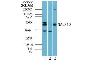 Image no. 1 for anti-NLR Family, Pyrin Domain Containing 10 (NLRP10) (AA 493-509) antibody (ABIN960280) (NLRP10 antibody  (AA 493-509))