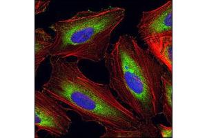 Image no. 1 for anti-Eukaryotic Translation Elongation Factor 1 alpha 1 (EEF1A1) antibody (ABIN329131) (eEF1A1 antibody)