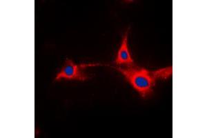 Immunofluorescent analysis of PFKFB2 staining in HepG2 cells. (PFKFB2 antibody  (N-Term))