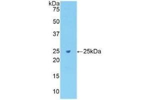 Detection of Recombinant Fibronectin, Rat using Polyclonal Antibody to Fibronectin (FN) (Fibronectin antibody  (AA 355-558))