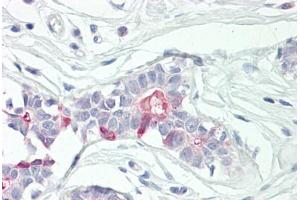 Image no. 3 for anti-Tumor Necrosis Factor, alpha-Induced Protein 8 (TNFAIP8) (AA 31-80) antibody (ABIN2879136)