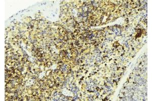 ABIN6274506 at 1/100 staining Mouse liver tissue by IHC-P.