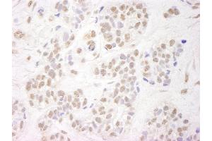 Immunohistochemistry (IHC) image for anti-Wolf-Hirschhorn Syndrome Candidate 2 (WHSC2) (AA 499-549) antibody (ABIN7448687)