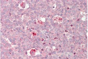 ABIN571244 (5µg/ml) staining of paraffin embedded Human Tonsil. (BIRC3 antibody  (Internal Region))