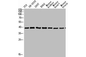 Western Blot analysis of various cells using Antibody diluted at 1:1000. (KIR3DL1 antibody  (N-Term))